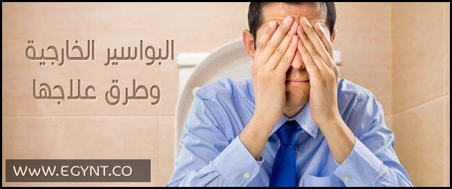 علاج البواسير الخارجية بدون جراحة
