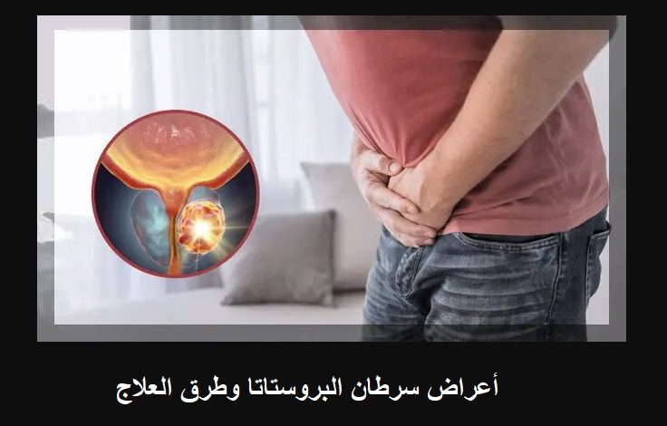 أعراض سرطان البروستاتا وطرق العلاج