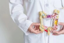 اطعمة تهيج القولون