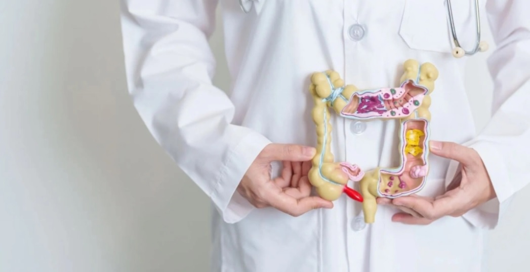 اطعمة تهيج القولون: ماذا يجب أن تتجنب لحماية جهازك الهضمي؟ 1 اطعمة تهيج القولون